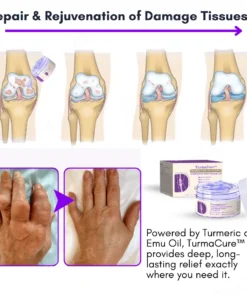 TurmaCure™ Turmeric eta Emu Olioa Artritisa Mina arintzeko Gela masajea