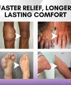 Gel de massage apaisant pour l'arthrite TurmaCure™ au curcuma et à l'huile d'émeu