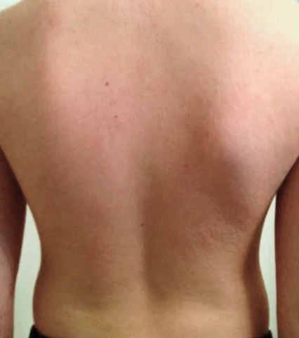 Winter Sale AEXZR™ Violet Eczema Treatment Cream