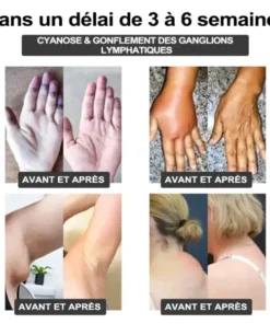 𝐂𝐙𝐓𝐈𝐂𝐋𝐄® 𝐁𝐫𝐚𝐜𝐞𝐥𝐞𝐭 𝐔𝐥𝐭𝐫𝐚𝐬𝐨𝐧𝐢𝐪𝐮𝐞 𝐝𝐞 𝐂𝐚𝐯𝐢𝐭𝐚𝐭𝐢𝐨𝐧 𝐞𝐭 𝐝𝐞 𝐃é𝐭𝐨𝐱𝐢𝐟𝐢𝐜𝐚𝐭𝐢𝐨𝐧