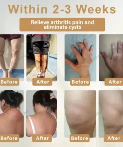 ATTDX® Emu Oil Turmeric Bone Sooth Gel
