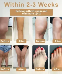 ATTDX® Emu Oil Turmeric Bone Sooth Gel