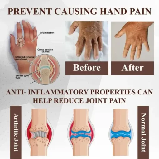 ATTDX® Emu Oil Turmeric Bone Sooth Gel