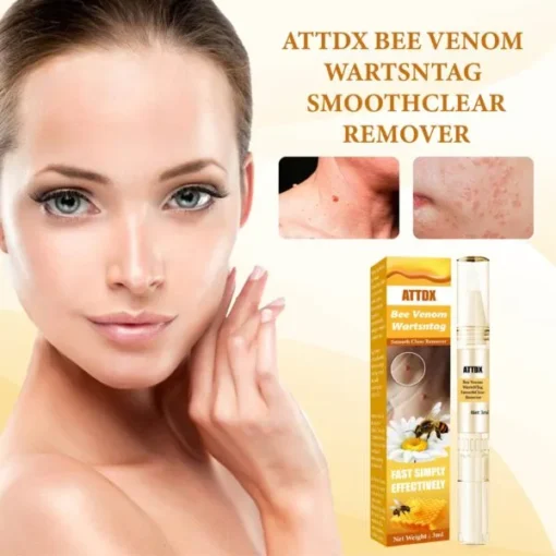 봉독사마귀NTag SmoothClear 리무버