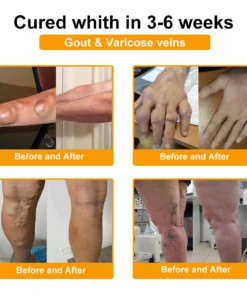 Botulinum Toxin & Bee Venom Ortopédiai Relief Krém 👩🏼‍⚕️ FDA által regisztrált | Amerikai Ortopédiai Szövetség (AOA) jóváhagyta