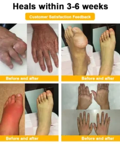 Botulinum Toxin & Bee Venom Ortopédiai Relief Krém 👩🏼‍⚕️ FDA által regisztrált | Amerikai Ortopédiai Szövetség (AOA) jóváhagyta