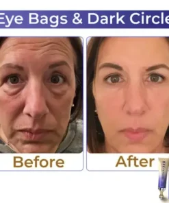 Collagen+ Bee Venom Roller Eye Cream Dermatologist-approved