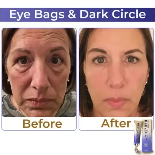 Collagen+ Bee Venom Roller Eye Cream Dermatologist-approved