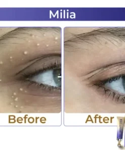 Collagen+ Bee Venom Roller Eye Cream Dermatologist-approved