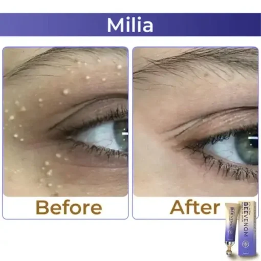 Collagen+ Bee Venom Roller Eye Cream Dermatologist-approved