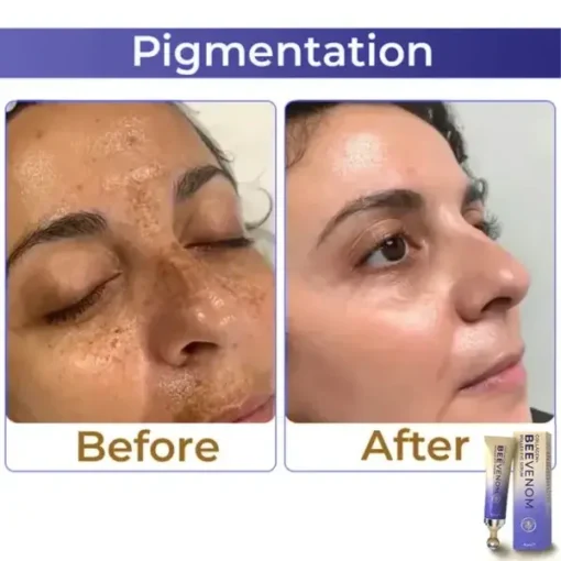 Collagen+ Bee Venom Roller Eye Cream Dermatologist-approved
