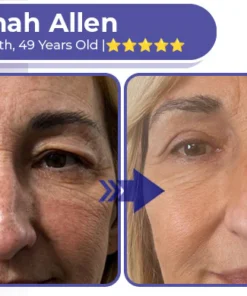 Collagen+ Bee Venom Roller Eye Cream Dermatologist-approved