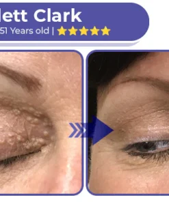 Collagen+ Bee Venom Roller Eye Cream Dermatologist-approved