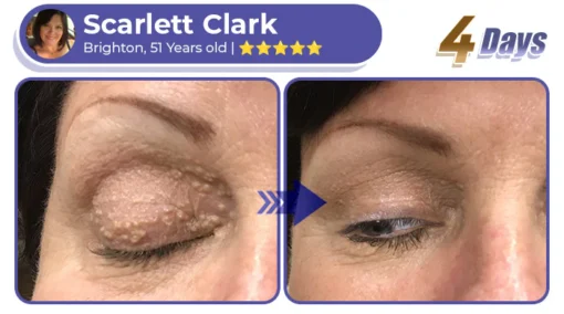 Collagen+ Bee Venom Roller Eye Cream Dermatologist-approved
