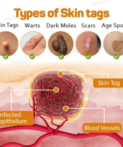Flysmus® Tag Recede Bee Venom tratamendu krema