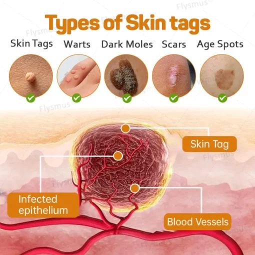 Flysmus® Tag Recede Bee Venom tratamendu krema