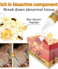 Flysmus® Tag Recede Bee Venom tratamendu krema