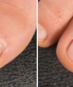 LIMETOW® BeeVenom Anti-Fungal Nail Renewal Oil