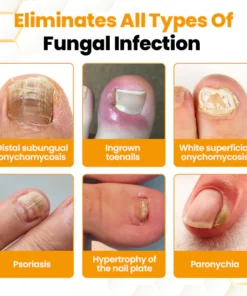 LIMETOW® BeeVenom Anti-Fungal Nail Renewal Oil