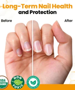 LIMETOW® BeeVenom Anti-Fungal Nail Renewal Oil