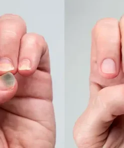 LIMETOW® BeeVenom Anti-Fungal Nail Renewal Oil