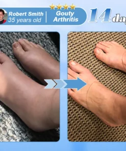 Hivatalos bolt: az AAOS által ajánlott EQVP® nano-mikrotűs ízületi tapasz