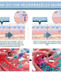 Hivatalos bolt: az AAOS által ajánlott EQVP® nano-mikrotűs ízületi tapasz