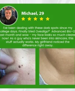 Oveallgo® Advanced Bio-Oil Mole & Spot Corrector