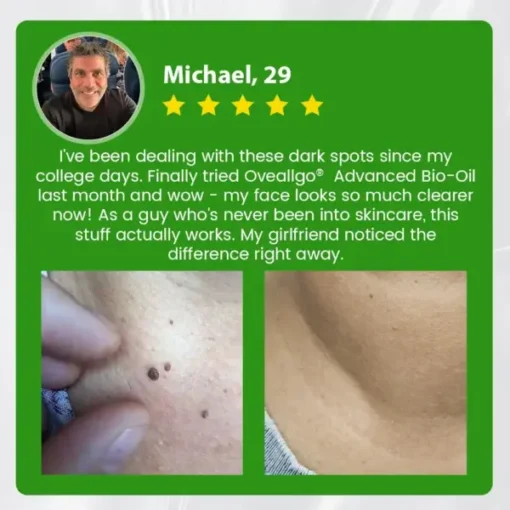 Oveallgo® Advanced Bio-Oil Mole & Spot Corrector