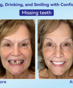 𝐁𝐢𝐤𝐞𝐧𝐝𝐚® 𝐏𝐫𝐞𝐦𝐢𝐮𝐦 𝐃𝐞𝐧𝐭𝐮𝐫𝐞