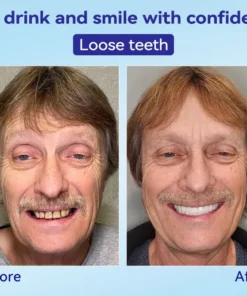 𝐁𝐢𝐤𝐞𝐧𝐝𝐚® 𝐏𝐫𝐞𝐦𝐢𝐮𝐦 𝐃𝐞𝐧𝐭𝐮𝐫𝐞