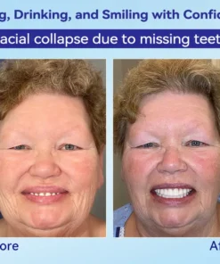 𝐁𝐢𝐤𝐞𝐧𝐝𝐚® 𝐏𝐫𝐞𝐦𝐢𝐮𝐦 𝐃𝐞𝐧𝐭𝐮𝐫𝐞