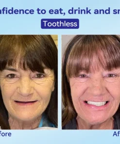 𝐁𝐢𝐤𝐞𝐧𝐝𝐚® 𝐏𝐫𝐞𝐦𝐢𝐮𝐦 𝐃𝐞𝐧𝐭𝐮𝐫𝐞