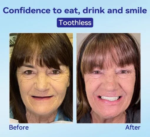 𝐁𝐢𝐤𝐞𝐧𝐝𝐚® 𝐏𝐫𝐞𝐦𝐢𝐮𝐦 𝐃𝐞𝐧𝐭𝐮𝐫𝐞