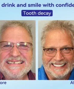 𝐁𝐢𝐤𝐞𝐧𝐝𝐚® 𝐏𝐫𝐞𝐦𝐢𝐮𝐦 𝐃𝐞𝐧𝐭𝐮𝐫𝐞