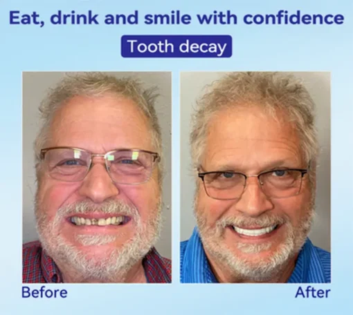𝐁𝐢𝐤𝐞𝐧𝐝𝐚® 𝐏𝐫𝐞𝐦𝐢𝐮𝐦 𝐃𝐞𝐧𝐭𝐮𝐫𝐞