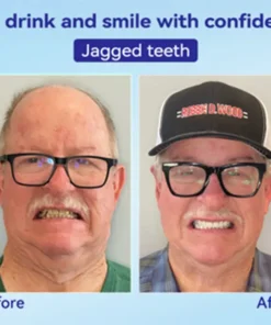 𝐁𝐢𝐤𝐞𝐧𝐝𝐚® 𝐏𝐫𝐞𝐦𝐢𝐮𝐦 𝐃𝐞𝐧𝐭𝐮𝐫𝐞