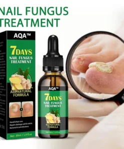 AQA™ – imbierinių nagų gydymas Nagų palaikymas Nagų priežiūra