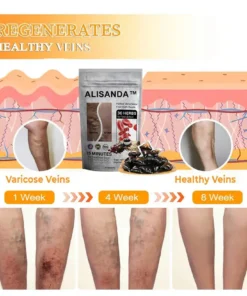 Hạt ngâm chân thảo dược Alisanda™ VenoDetox (Hạt massage chân thảo dược Alisanda™ Herbal VenoDetox)