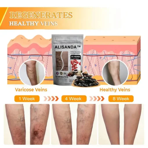 Hạt ngâm chân thảo dược Alisanda™ VenoDetox (Hạt massage chân thảo dược Alisanda™ Herbal VenoDetox)