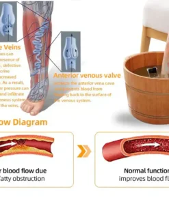 Hạt ngâm chân thảo dược Alisanda™ VenoDetox (Hạt massage chân thảo dược Alisanda™ Herbal VenoDetox)