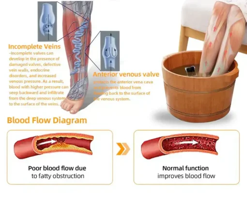 Hạt ngâm chân thảo dược Alisanda™ VenoDetox (Hạt massage chân thảo dược Alisanda™ Herbal VenoDetox)
