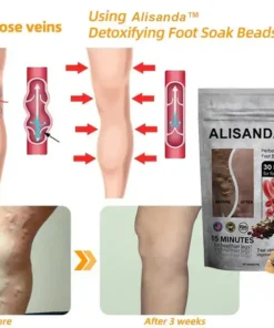 Hạt ngâm chân thảo dược Alisanda™ VenoDetox (Hạt massage chân thảo dược Alisanda™ Herbal VenoDetox)