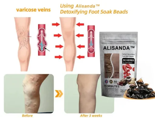 Hạt ngâm chân thảo dược Alisanda™ VenoDetox (Hạt massage chân thảo dược Alisanda™ Herbal VenoDetox)
