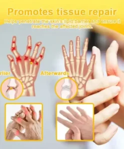 Botulinum Toxin & Bee Venom Orthopedic Relief Cream