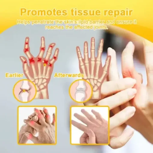 Botulinum Toxin & Bee Venom Orthopedic Relief Cream