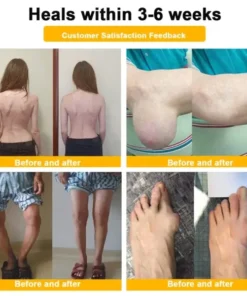 Botulinum Toxin & Bee Venom Orthopedic Relief Cream