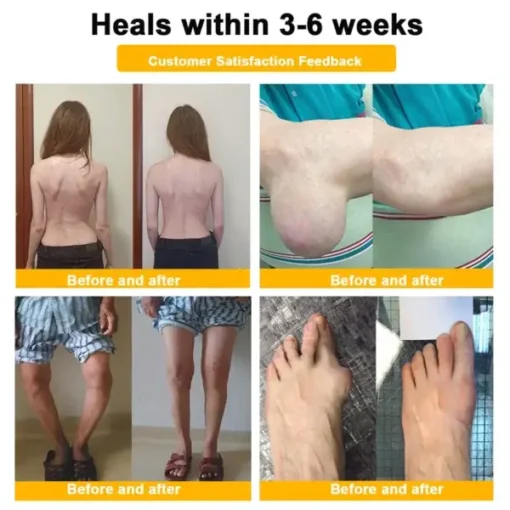 Botulinum Toxin & Bee Venom Orthopedic Relief Cream