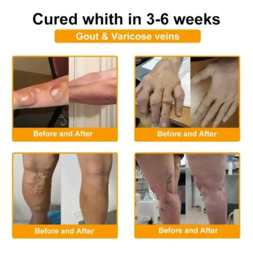 Botulinum Toxin & Bee Venom Orthopedic Relief Cream