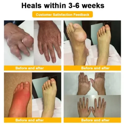 Botulinum Toxin & Bee Venom Orthopedic Relief Cream